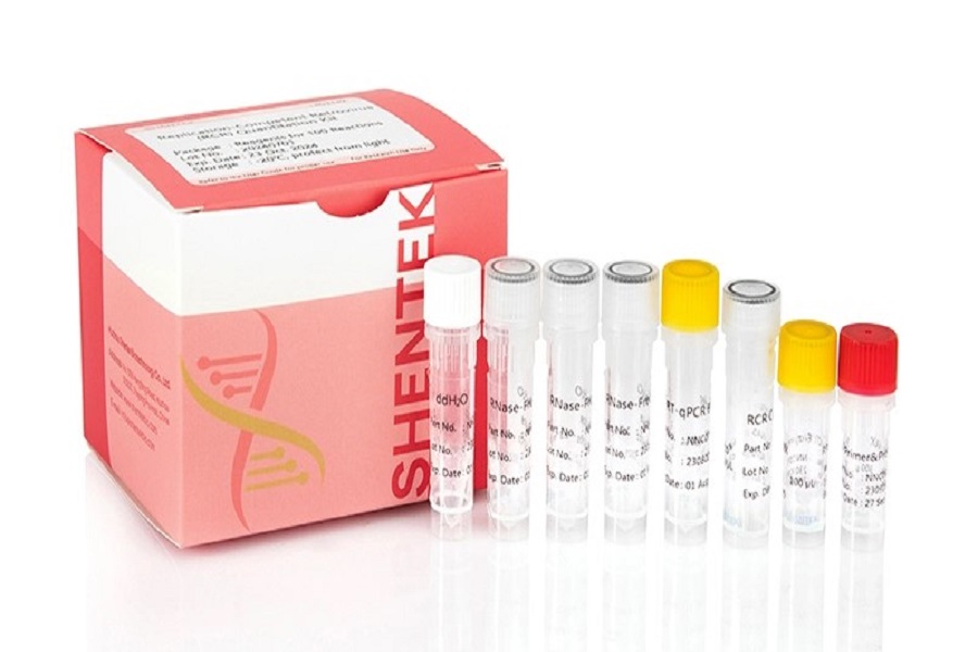 RCR 테스트의 주요 방법